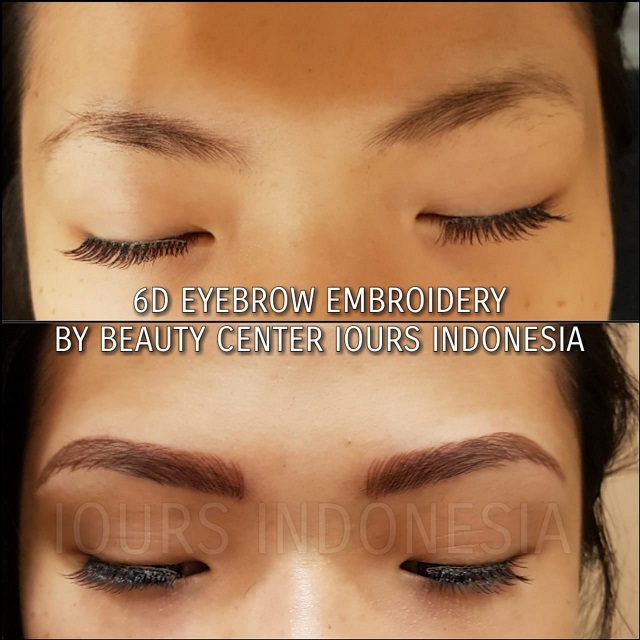 Beauty Treatment